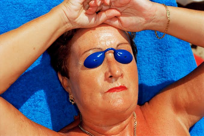 Benidorm, Spain sunbather with blue eye shields